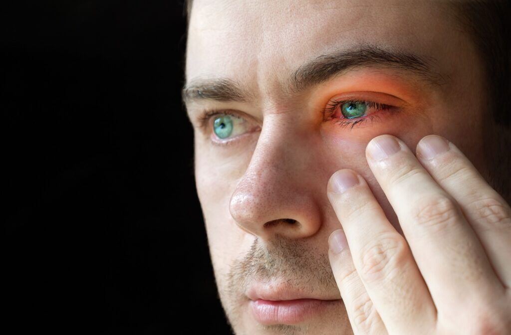 A close-up of a man rubbing his left bloodshot eye. His eyelids are highlighted with a red glow, suggesting inflammation.