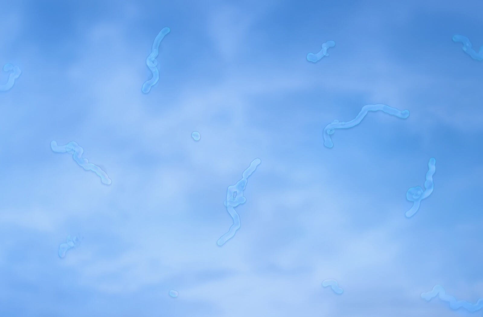 Subtle squiggly lines (eye floaters) drifting across a clear blue sky.