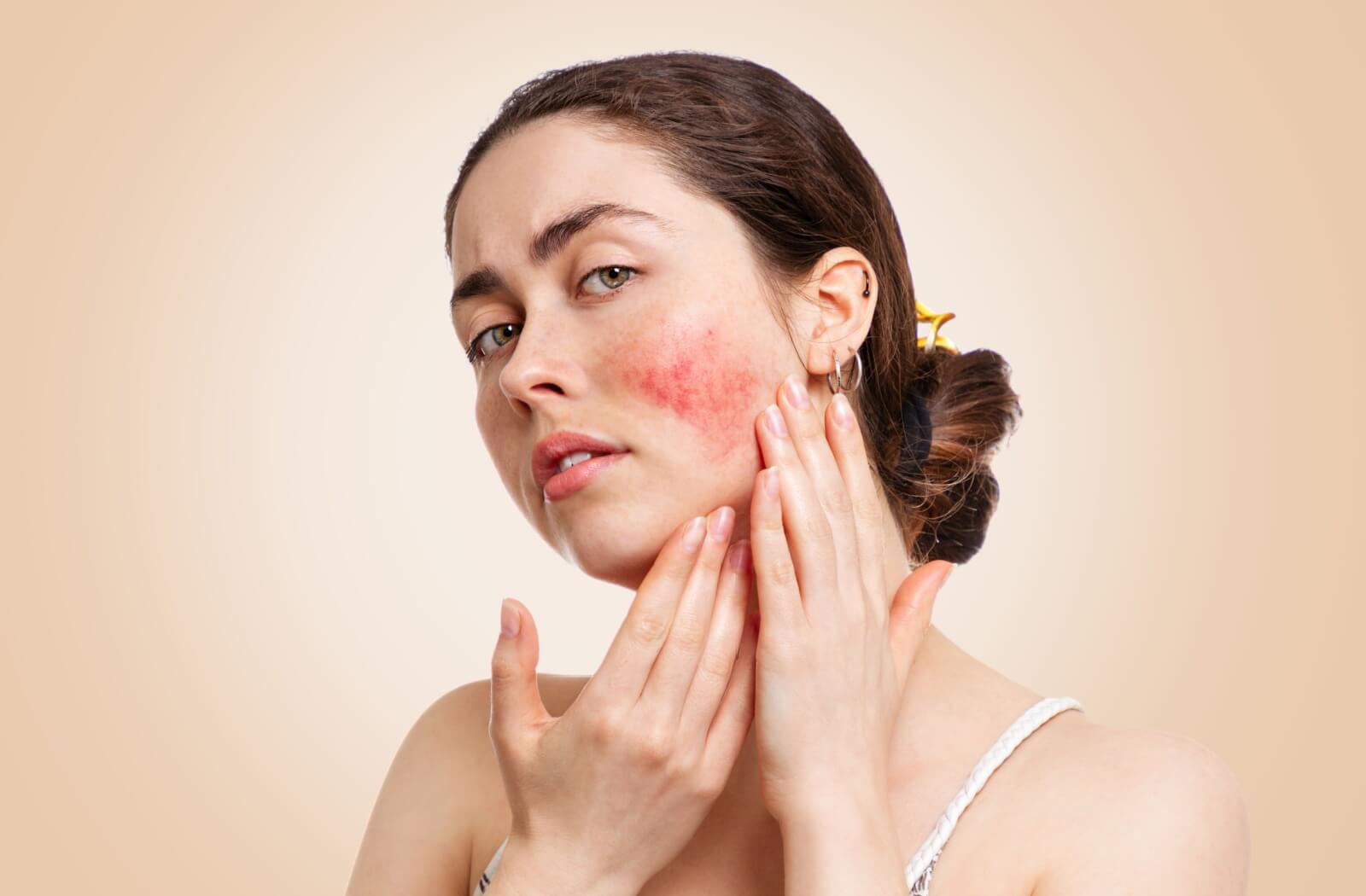 A person assesses the red patch of skin on their cheek.